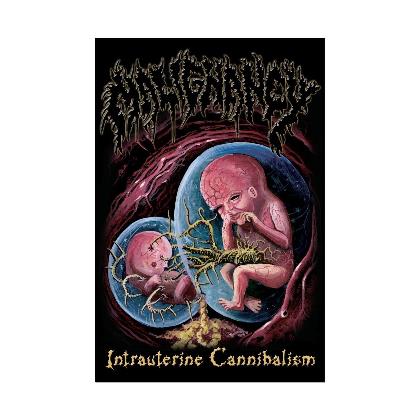 Malignancy - Intrauterine Cannibalism 24x36 Semi-Gloss Poster