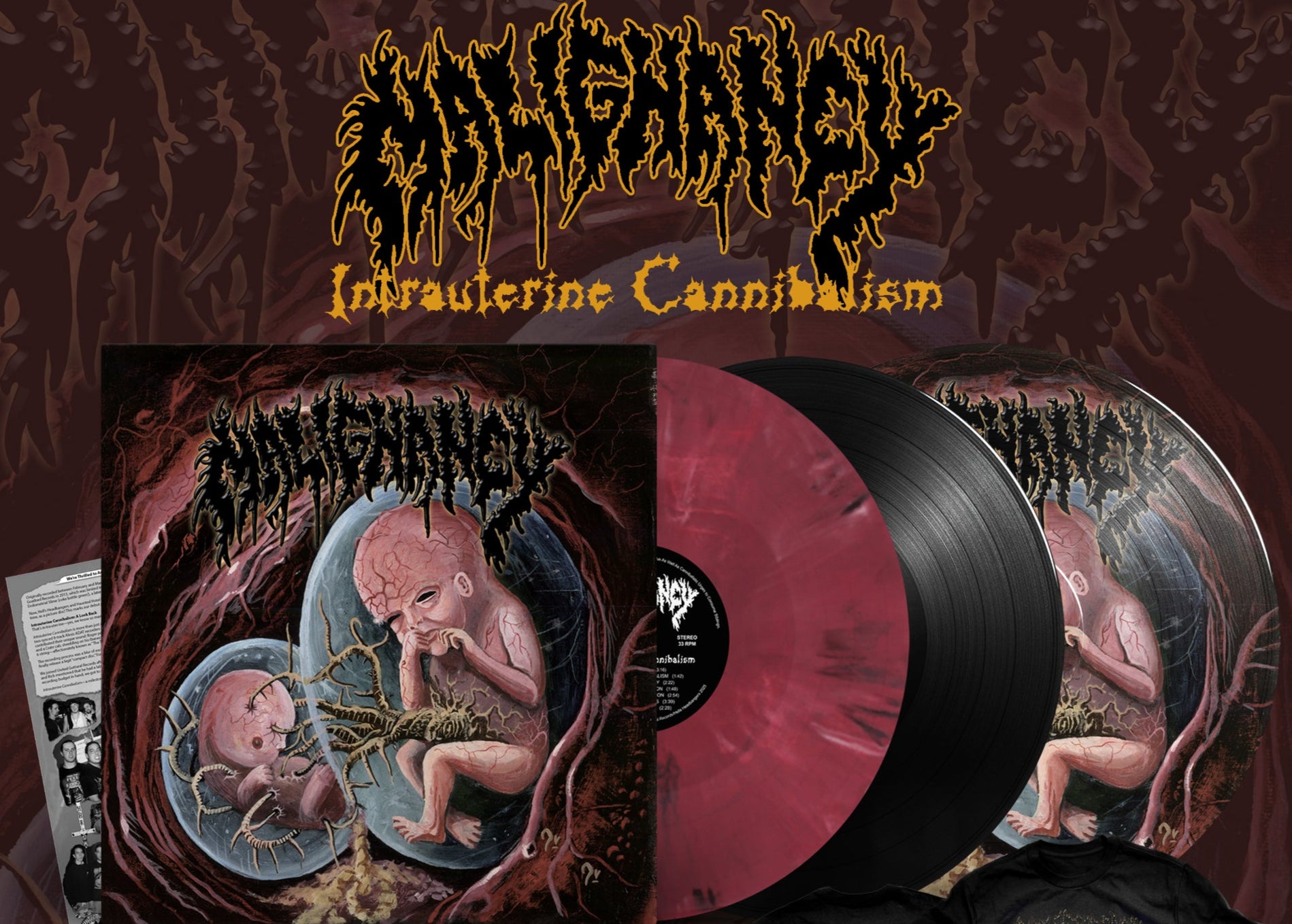 Intrauterine Cannibalism 12