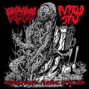 Intracranial Fungal Infection Split