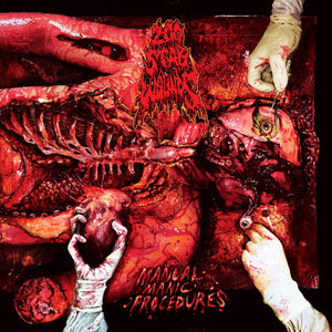 Manual Manic Procedures 12" Vinyl