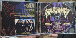 Frailty of the Human Condition CD Jewel Case Version